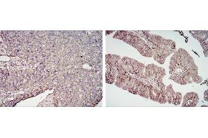 Image no. 3 for anti-CD276 (CD276) antibody (ABIN969018)