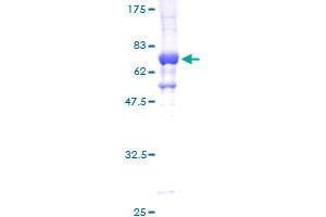 Image no. 2 for serine/threonine Kinase 32C (STK32C) (AA 1-369) protein (GST tag) (ABIN1321692)
