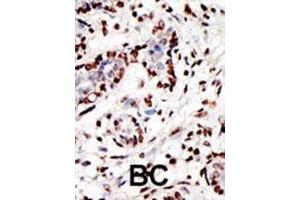 Image no. 1 for anti-Myeloid/lymphoid Or Mixed-Lineage Leukemia (MLL) (AA 3879-3908), (C-Term) antibody (ABIN387979)