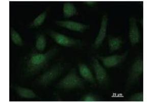 Image no. 2 for anti-SATB Homeobox 1 (SATB1) antibody (ABIN932488)