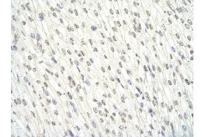 Image no. 5 for anti-Ewing Sarcoma Breakpoint Region 1 (EWSR1) (Middle Region) antibody (ABIN2779045)