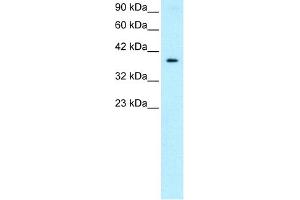 Image no. 1 for anti-5'-Nucleotidase, Cytosolic III (NT5C3) (Middle Region) antibody (ABIN2779493)