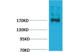 Western Blotting (WB) image for anti-Ectopic P-Granules Autophagy Protein 5 Homolog (EPG5) antibody (ABIN3181523)