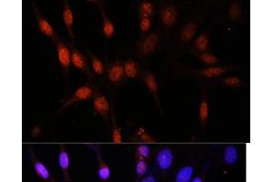 Immunofluorescence analysis of NIH/3T3 cells using KAT6A Polyclonal Antibody at dilution of 1:100.
