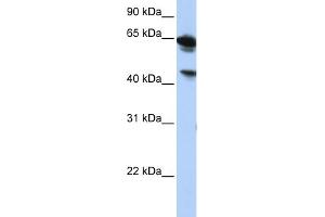 Image no. 1 for anti-Abhydrolase Domain Containing 16A (ABHD16A) (Middle Region) antibody (ABIN2783826)