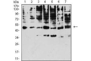 Image no. 3 for anti-Killer Cell Immunoglobulin-Like Receptor, three Domains, Long Cytoplasmic Tail, 1 (KIR3DL1) (AA 22-340) antibody (ABIN5611327)