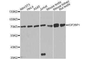 Image no. 2 for anti-Insulin-Like Growth Factor 2 mRNA Binding Protein 1 (IGF2BP1) antibody (ABIN3022057)