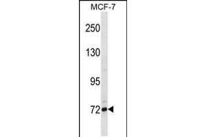 Image no. 1 for anti-Fc Receptor-Like 5 (FCRL5) (AA 302-331) antibody (ABIN5535976)