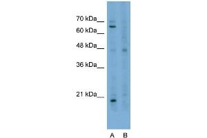 Image no. 2 for anti-Staufen Double-Stranded RNA Binding Protein 1 (STAU1) (N-Term) antibody (ABIN2778907)