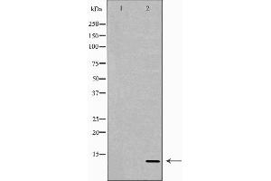 Image no. 2 for anti-Neuregulin 4 (NRG4) (C-Term) antibody (ABIN6263735)