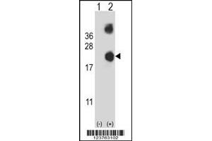 Western Blotting (WB) image for anti-Destrin (Actin Depolymerizing Factor) (DSTN) antibody (ABIN2158605)