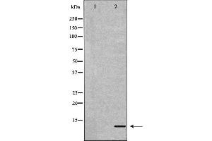 Image no. 1 for anti-Apolipoprotein C-II (APOC2) (Internal Region) antibody (ABIN6259990)