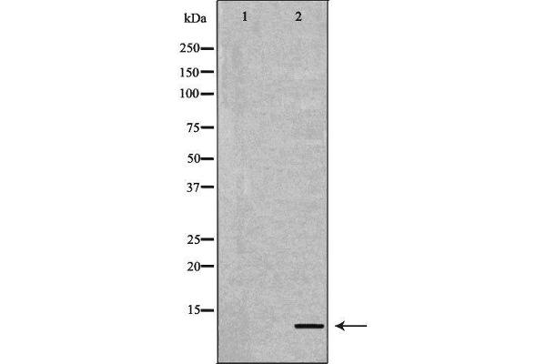 anti-Apolipoprotein C-II (APOC2) (Internal Region) antibody