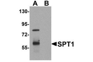 Image no. 1 for anti-tRNA-YW Synthesizing Protein 1 Homolog (TYW1) (C-Term) antibody (ABIN783488)