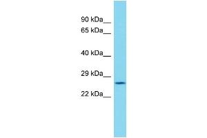 TIMM29 antibody  (C-Term)