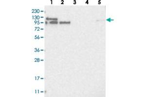 Image no. 1 for anti-La Ribonucleoprotein Domain Family, Member 4B (LARP4B) antibody (ABIN5582387)