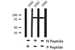 Image no. 3 for anti-Eukaryotic Translation Initiation Factor 2B, Subunit 5 Epsilon, 82kDa (EIF2B5) (pSer525) antibody (ABIN6271588)