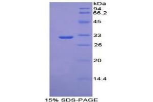 Image no. 1 for phosphoenolpyruvate Carboxykinase 1 (Soluble) (PCK1) (Soluble) protein (ABIN3011147)