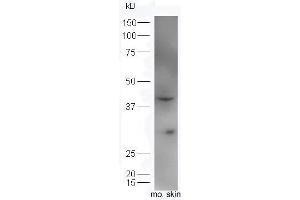 Image no. 1 for anti-Interleukin 34 (IL34) (AA 21-100) antibody (ABIN2176999)