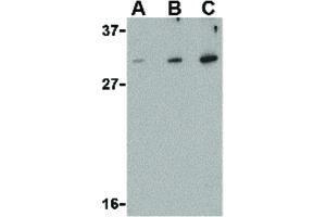 Image no. 5 for anti-DNA-Damage Regulated Autophagy Modulator 1 (DRAM1) (C-Term) antibody (ABIN6656858)
