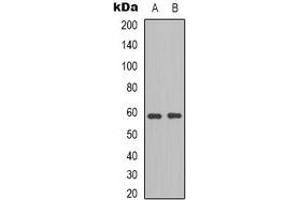 Image no. 2 for anti-B Lymphoid Tyrosine Kinase (BLK) (C-Term) antibody (ABIN2957880)