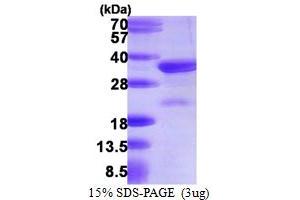 Image no. 1 for Charged Multivesicular Body Protein 3 (CHMP3) (AA 1-222) protein (His tag) (ABIN667482)