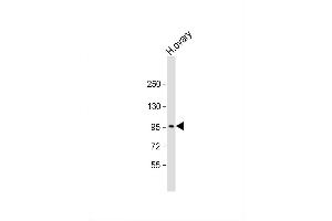 Image no. 3 for anti-Low Density Lipoprotein Receptor-Related Protein 3 (LRP3) (AA 661-692), (C-Term) antibody (ABIN390097)