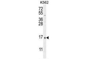 Image no. 2 for anti-Calcitonin-Related Polypeptide alpha (CALCA) (AA 63-91), (Middle Region) antibody (ABIN951490)