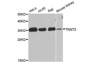 Image no. 2 for anti-Troponin T2, Cardiac (TNNT2) antibody (ABIN3021486)