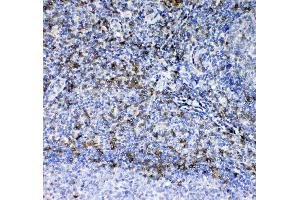 Image no. 1 for anti-CD7 (CD7) (AA 26-172) antibody (ABIN5692820)