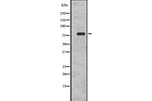 Image no. 1 for anti-KDEL (Lys-Asp-Glu-Leu) Endoplasmic Reticulum Protein Retention Receptor 1 (KDELR1) (Internal Region) antibody (ABIN6262763)