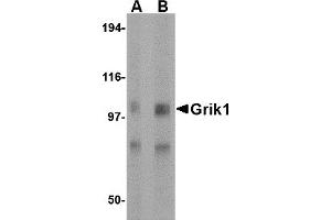 Western Blotting (WB) image for anti-Glutamate Receptor, Ionotropic, Kainate 1 (GRIK1) (Middle Region) antibody (ABIN1030944)