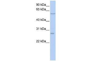 Image no. 1 for anti-Neuropilin (NRP) and Tolloid (TLL)-Like 2 (NETO2) (N-Term) antibody (ABIN2782941)