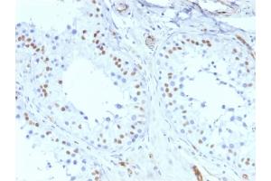 Image no. 4 for anti-Wilms Tumor 1 (WT1) antibody (ABIN6940904)