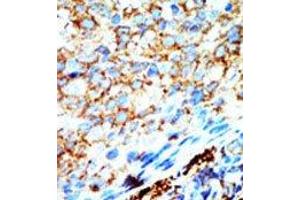 Image no. 1 for anti-NME/NM23 Nucleoside Diphosphate Kinase 4 (NME4) (C-Term) antibody (ABIN360669)