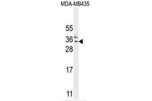 Image no. 4 for anti-Chromosome 11 Open Reading Frame 73 (C11orf73) (AA 9-39), (N-Term) antibody (ABIN950728)