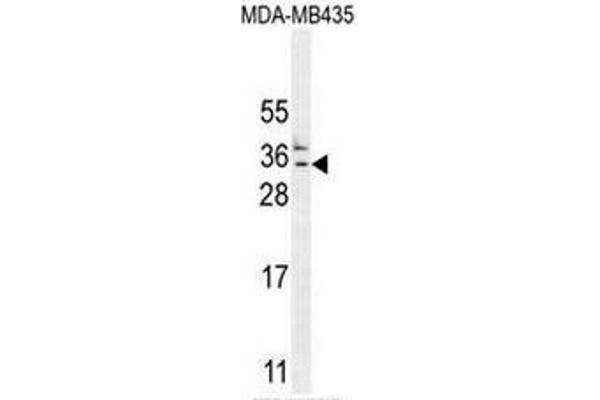 C11orf73 antibody  (N-Term)