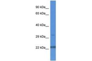 Image no. 1 for anti-Nudix (Nucleoside Diphosphate Linked Moiety X)-Type Motif 22 (NUDT22) (AA 223-272) antibody (ABIN6746838)