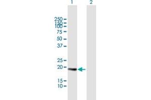 anti-Centrin, EF-Hand Protein, 3 (CETN3) (AA 1-167) antibody