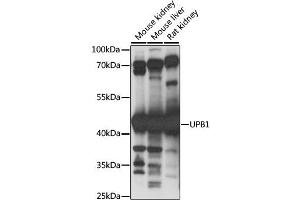 Image no. 1 for anti-Ureidopropionase, beta (UPB1) antibody (ABIN6568711)