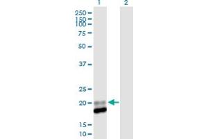 Image no. 1 for anti-Interferon, alpha 13 (IFNA13) (AA 1-189) antibody (ABIN516898)