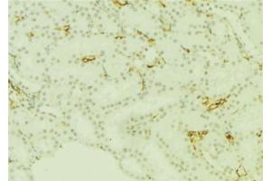 Image no. 2 for anti-Phospholipid Transfer Protein (PLTP) antibody (ABIN6264310)