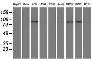 Image no. 3 for anti-Dipeptidyl-Peptidase 8 (DPP8) antibody (ABIN1497835)