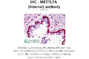 Image no. 2 for anti-Methyltransferase Like 7A (METTL7A) (Internal Region) antibody (ABIN1736924)