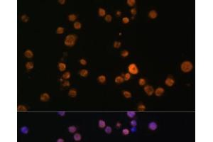 Immunofluorescence analysis of THP-1 cells using JAK3 Polyclonal Antibody at dilution of 1:100 (40x lens).