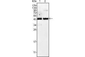 anti-alpha-Methylacyl-CoA Racemase (AMACR) antibody