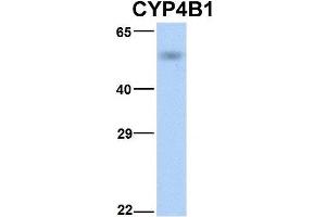 Image no. 2 for anti-Cytochrome P450, Family 4, Subfamily B, Polypeptide 1 (CYP4B1) (N-Term) antibody (ABIN2777006)
