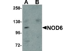 Image no. 1 for anti-NLR Family, Pyrin Domain Containing 9 (NLRP9) (N-Term) antibody (ABIN6655925)