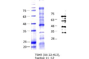 Image no. 4 for Thyroid Stimulating Hormone Receptor (TSHR) (AA 22-413) protein (His tag) (ABIN3134134)
