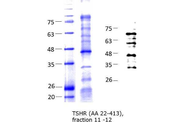 TSH receptor Protein (AA 22-413) (His tag)